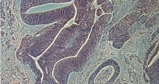 Células cutáneas humanas adquieren propiedades de células madre