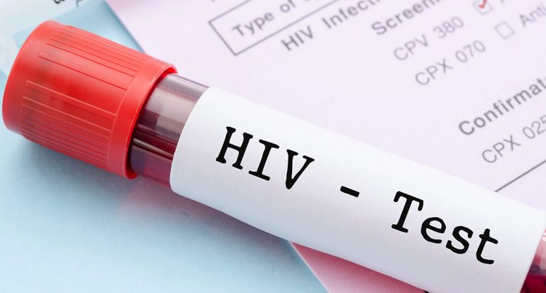 ¿Cuál es situación actual del VIH/SIDA en el mundo?