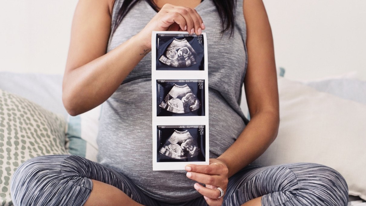Mujer embarazada y ultrasonido