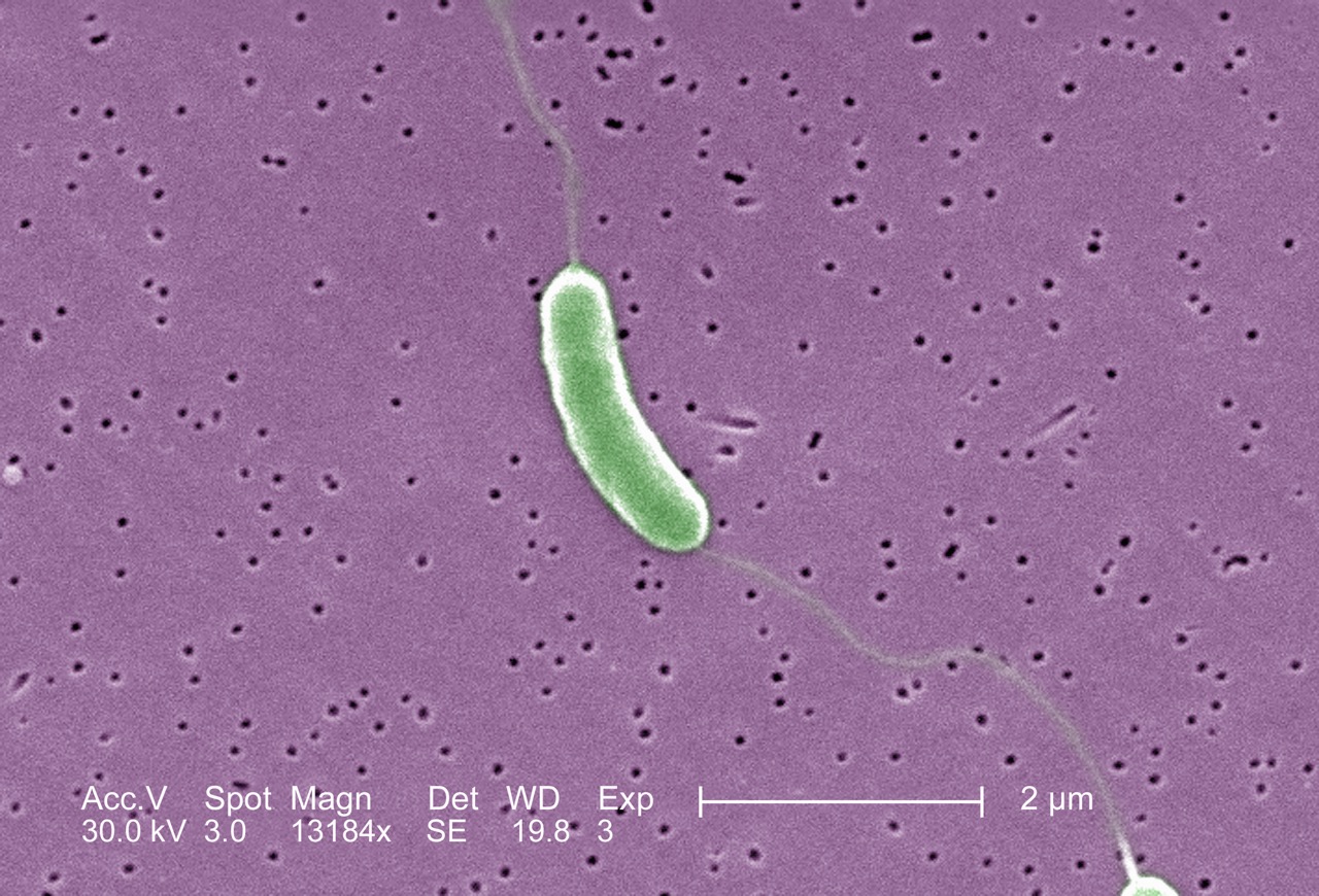 La bacteria "come carne", Vibrio vulnificus, vista a través de un microscopio