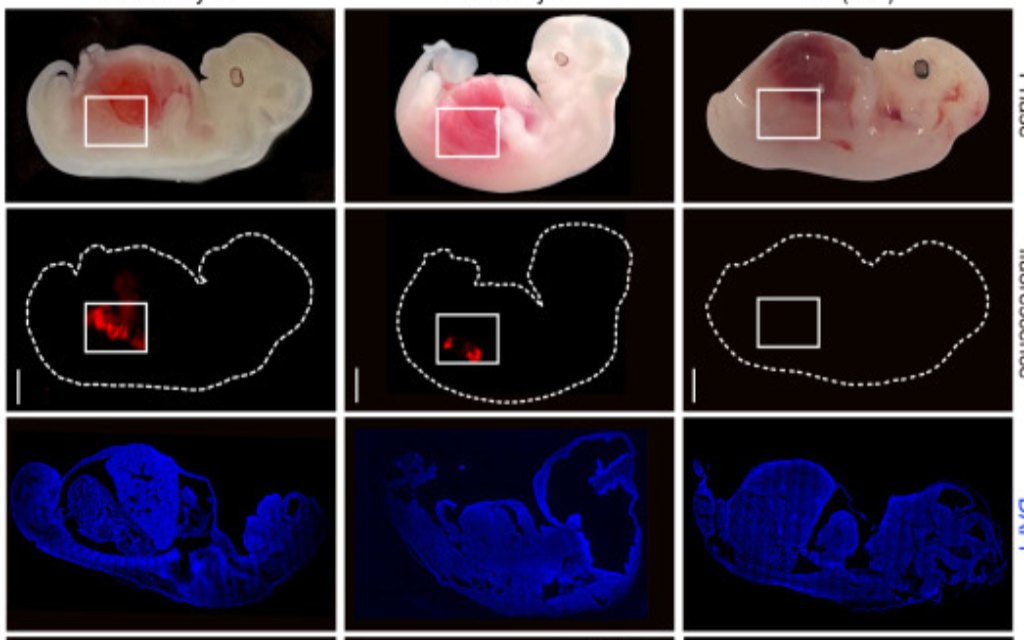 riñones humanos en embriones de cerdos
